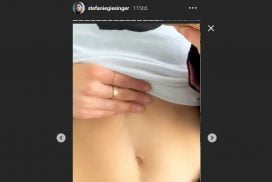 Nach OP: Stefanie Giesinger zeigt ihre Narbe 67 Nach OP: Stefanie Giesinger zeigt ihre Narbe