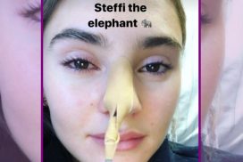 Stefanie Giesinger: Notaufnahme! 70 Stefanie Giesinger: Notaufnahme!