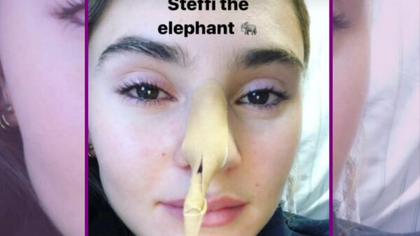 STARS 163 Stefanie Giesinger BILD Facebook
