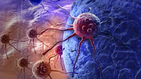 St 107 krebs BILD iStock