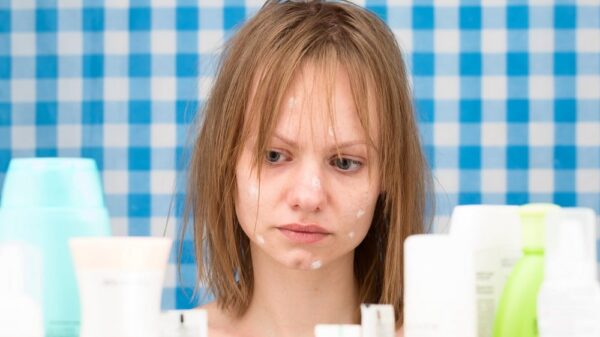 St 253 Pickel BILD iStock