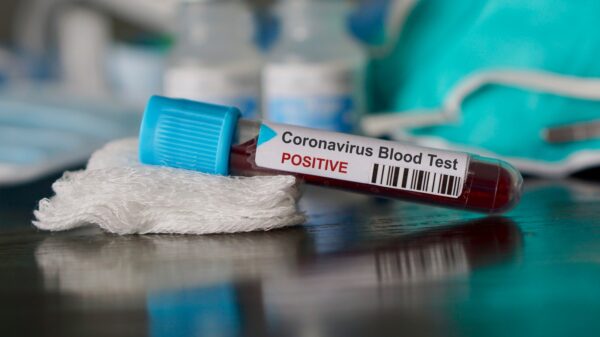 Coronavirus
