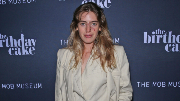 Clara McGregor mit Hundebiss im Gesicht bei Premiere