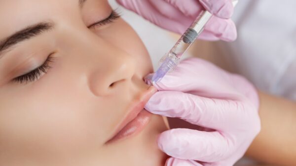 Lippen aufspritzen