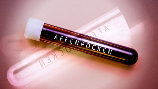 Affenpocken