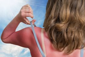 Frau schläft in der Sonne ein - und wacht mit Plastikgesicht auf 68 Frau schläft in der Sonne ein – und wacht mit Plastikgesicht auf