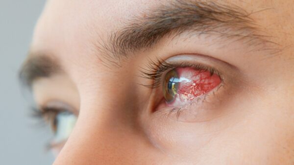 Auge