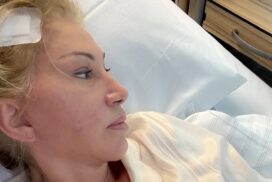 Neurologe erklärt: So läuft die Hirn-OP bei Carmen Geiss ab 66 Neurologe erklärt: So läuft die Hirn-OP bei Carmen Geiss ab
