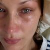 Bella Hadid spricht über ihre Krankheit: "Duschen, ohne ohnmächtig zu werden, ist eine Leistung" 55 Bella Hadid